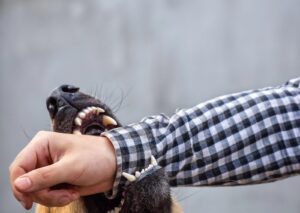 A dog with sharp teeth is biting the wrist of a man wearing a black and white plaid long-sleeved shirt.