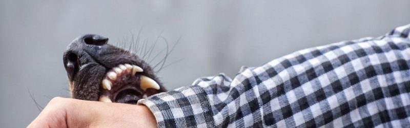 A dog with sharp teeth is biting the wrist of a man wearing a black and white plaid long-sleeved shirt.